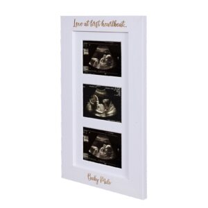 Baby Scan Photo Frame - Frame for three scan photos - available in 6 colours - Baby Reveal - Baby Shower - BF1