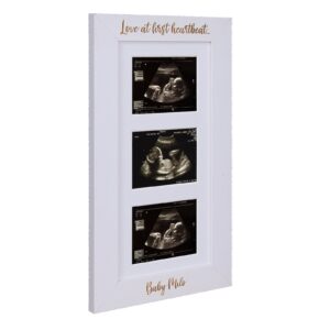 Baby Scan Photo Frame - Frame for three scan photos - available in 6 colours - Baby Reveal - Baby Shower - BF1