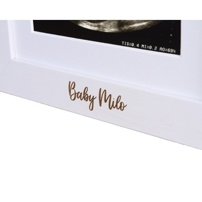 Baby Scan Picture Frame, New Dad Gift, Baby Shower Gift, Baby Reveal, Single Aperture - available in 6 colours - Single Image Version - BF2