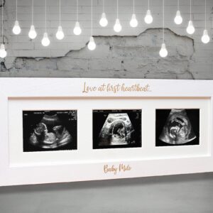 Baby Scan Picture Frame, Baby Shower Gift, New Dad Gift - BF3
